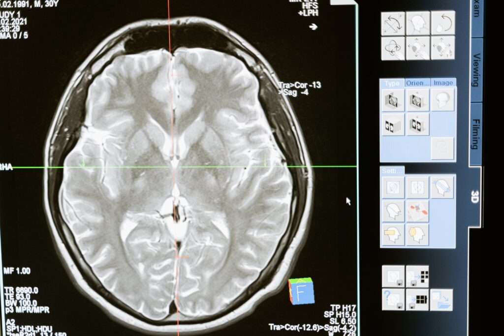 The Role of Radiology in Modern Medicine 3 x-ray