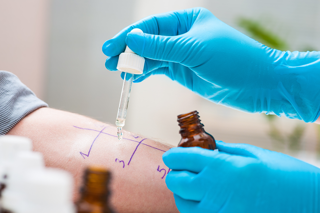 Allergy Marketing: How to Effectively Reach Your Audience 2 Allergy Marketing: How to Effectively Reach Your Audience - 1